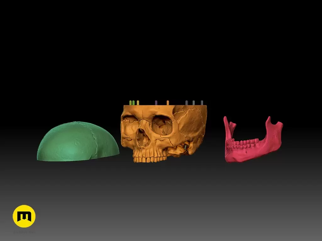 人类头骨的数字 3D 打印模型Anatomically Correct Human Skull (Homo Sapiens Sapiens)插图12